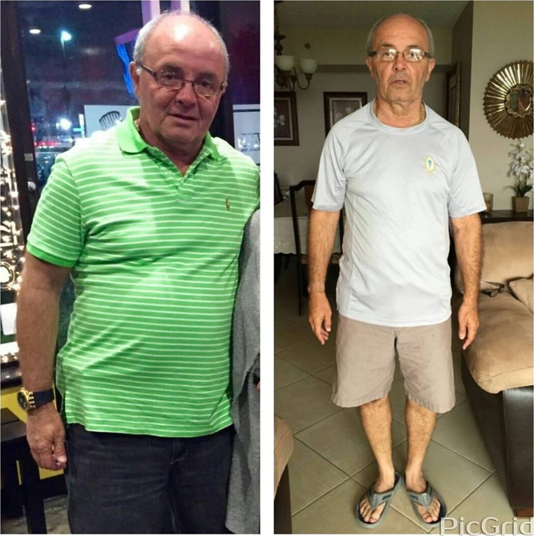 Antes y después de un cliente de Armando